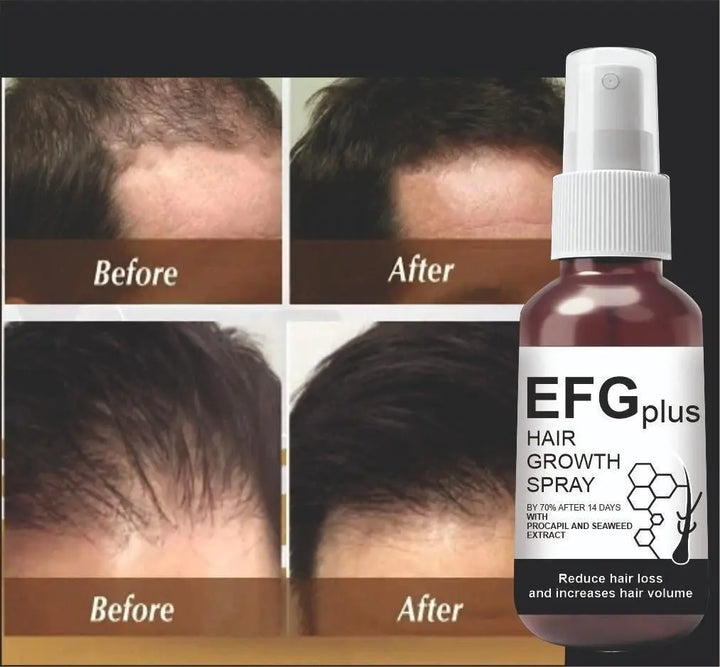 EFGPLUS Hair Growth Spray 50ml (Pack of 2) yxrqxm-xb