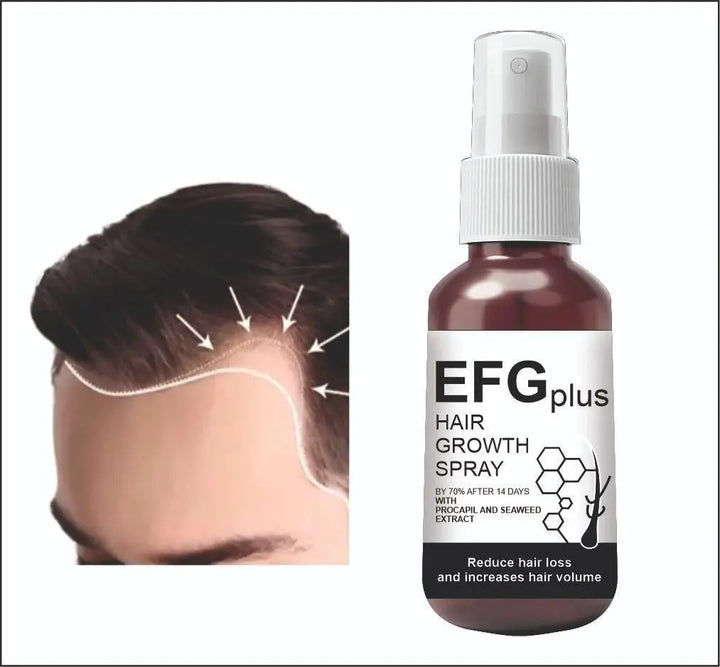 EFGPLUS Hair Growth Spray 50ml (Pack of 2) yxrqxm-xb